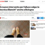 Bologna Today tecnica PBS articolo su cura alluce valgo