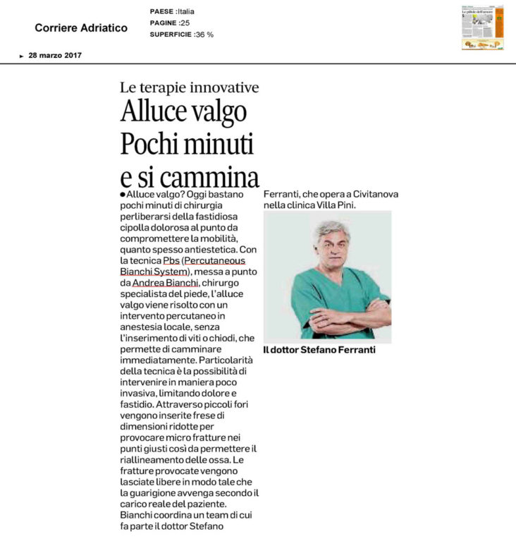 Articolo del Corriere Adriatico il Dott. Ferranti parla dell'intervento di alluce valgo con tecnica PBS