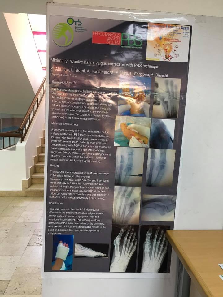 La tecnica PBS presentata in Egitto