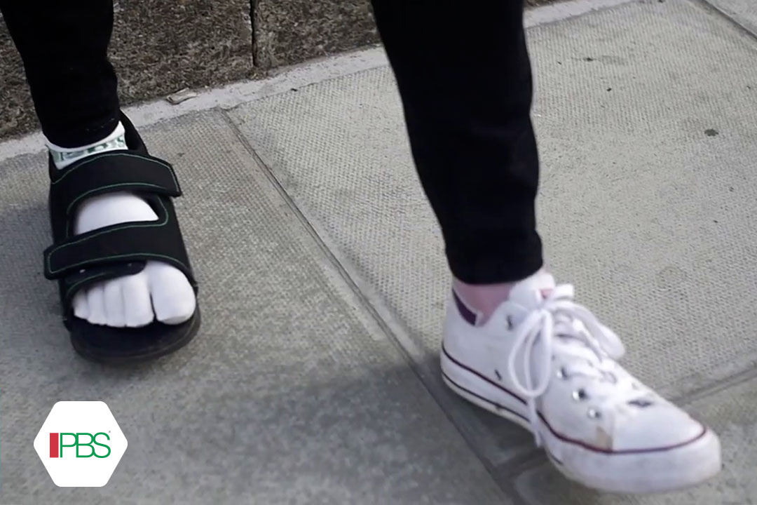 Scarpe comode dopo intervento alluce valgo hotsell