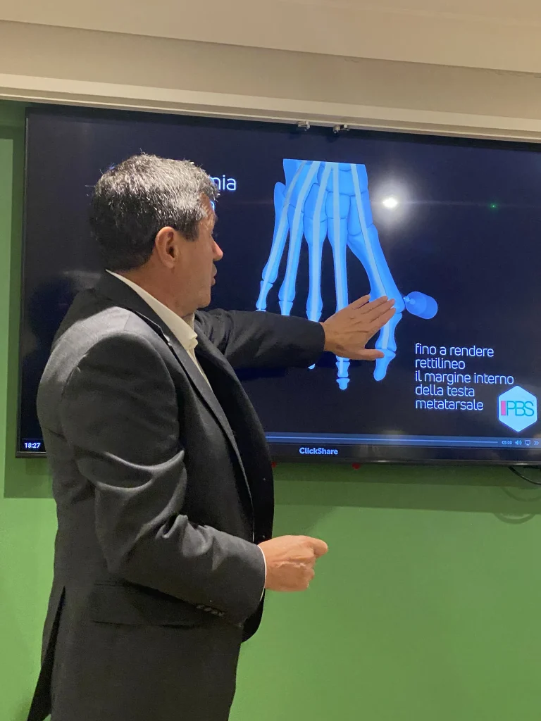 dr. bianchi lezione su tecnica PBS alluce valgo a londra