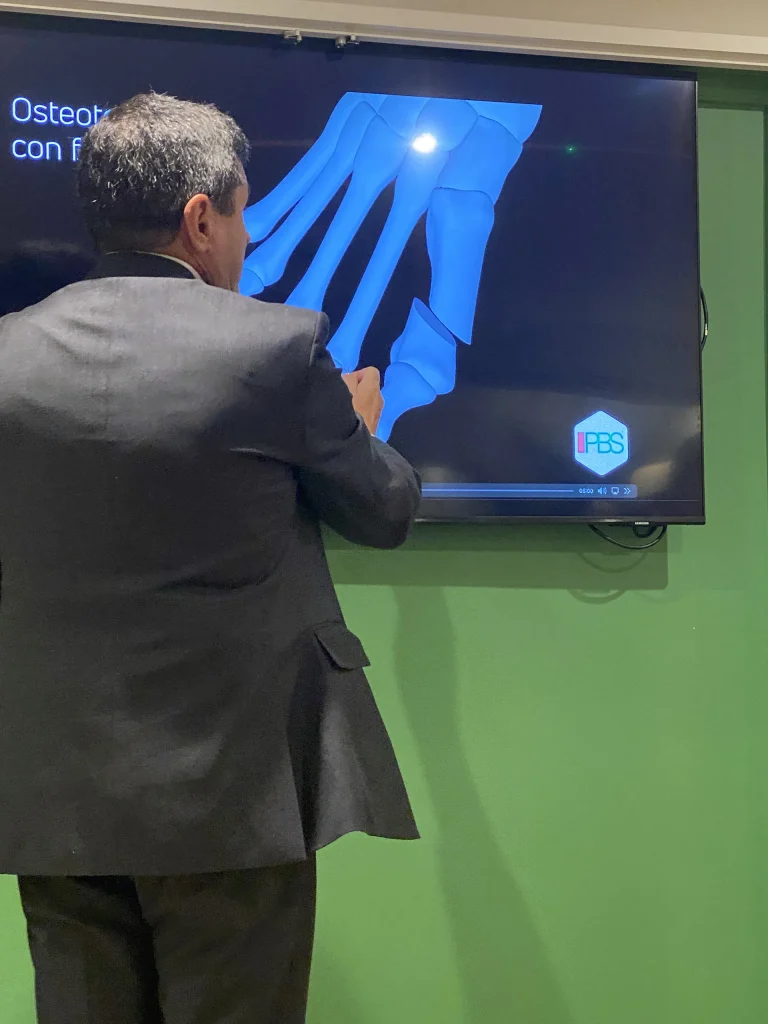 dr. bianchi lezione su tecnica PBS alluce valgo a londra