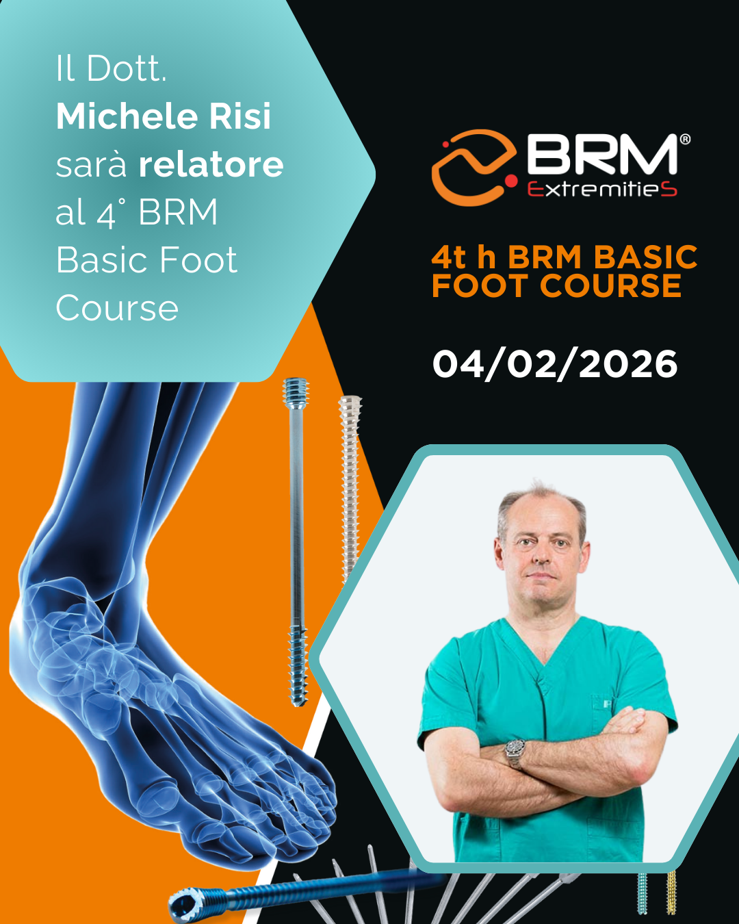 Dr Risi corso teorico pratico tecnica percutanea chirurgia del piede