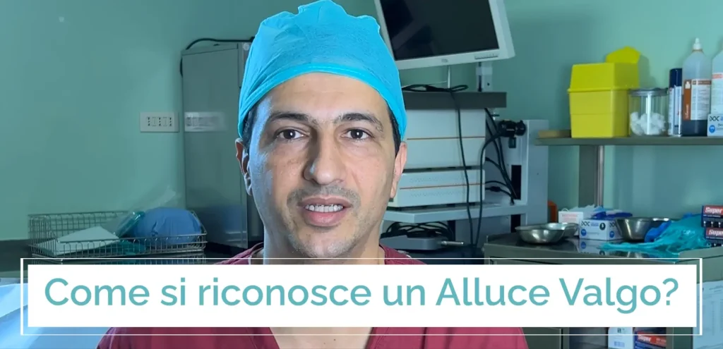 come si riconosce l'alluce valgo